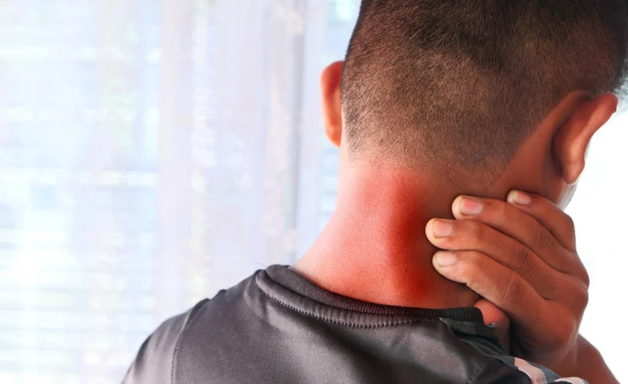 Câncer de cabeça e pescoço cresce no Brasil e exige atenção a sinais precoces