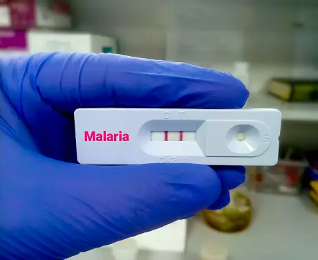 Fiocruz mantém investigação de ebola após viajante belga testar positivo para malária no Rio
